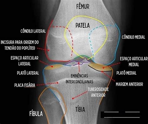 rotula de rodilla-1